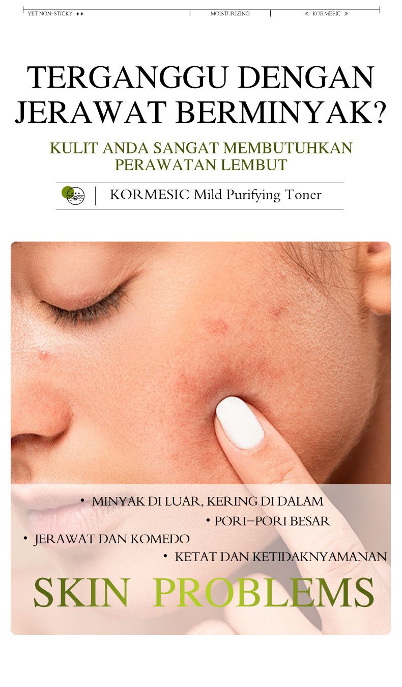 KORMESIC Gentle Toner Gezicht Hydraterend Hydraterend 130ml_voghion.com