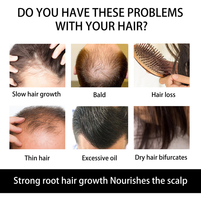 Jaysuing Scalp favorise l'épaississement du peigne à cheveux de massage à rouleaux_voghion.com