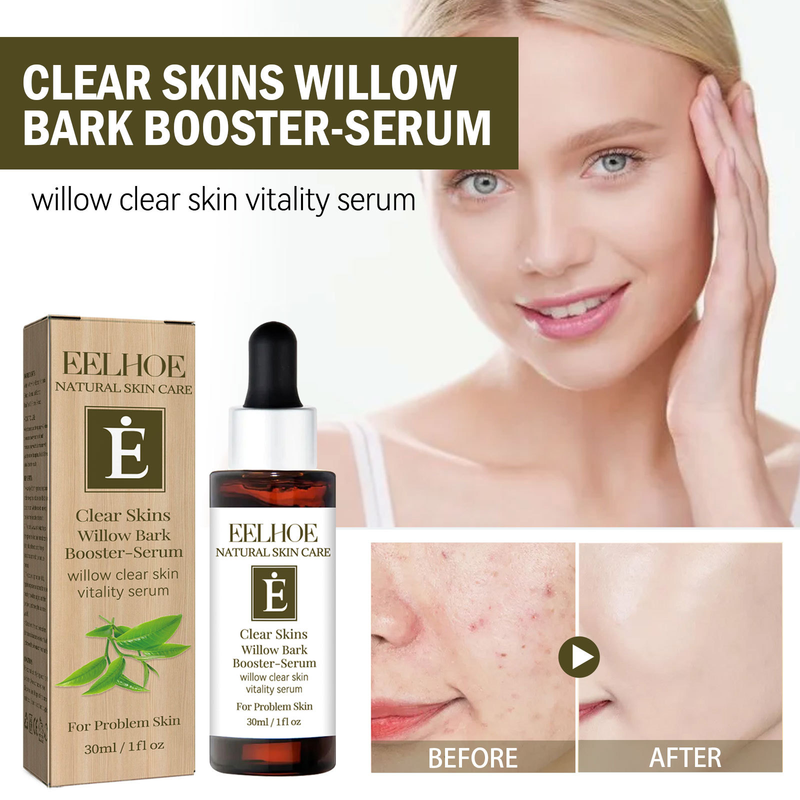 EELHOE Cleansing Willow Bark-essentie kan de droogheid verlichten, acnevlekken vervagen, de huid reinigen, hydrateren en een gevoelige huid veroorzaken_voghion.com