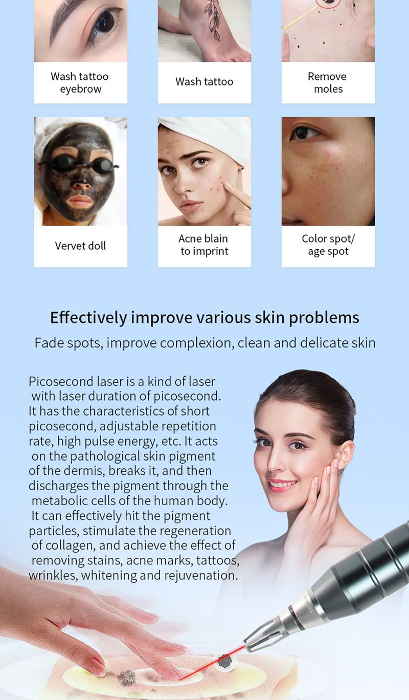 Picosecond Pen mitesszer eltávolító lézeres tetoválás eltávolító lézerrel, sötét foltokkal és demelaninnal_voghion.com