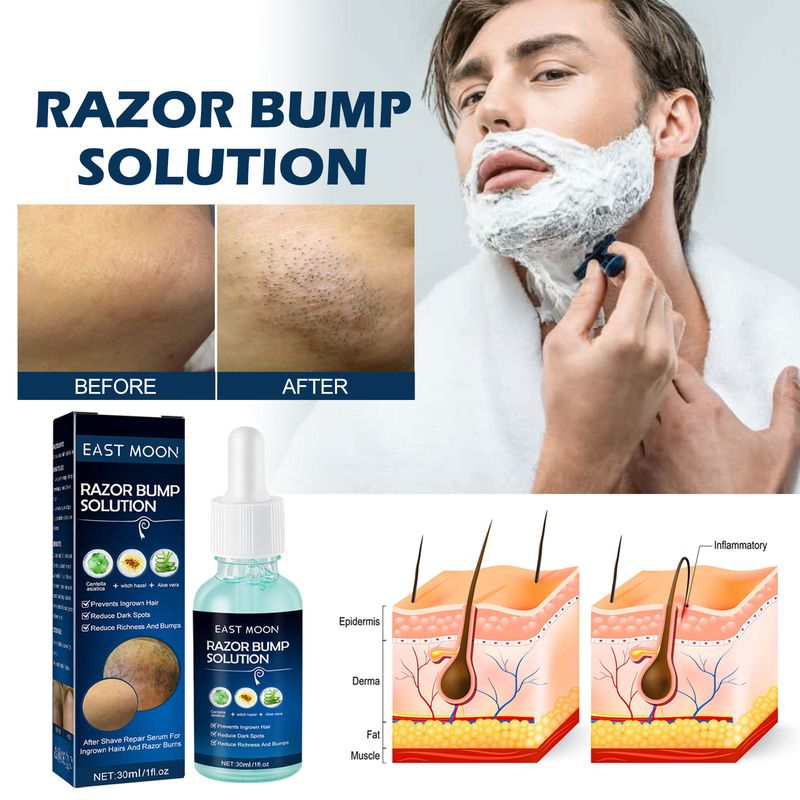East Moon antiesencia suave hidratante cuidado de la barba crecimiento del cabello corporal_voghion.com