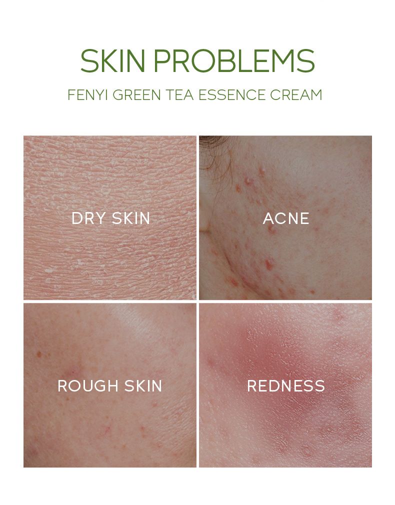 FENYI Grönt te 4 stycken hudvårdsprodukt Resestorlek Prov 1 stycke_voghion.com