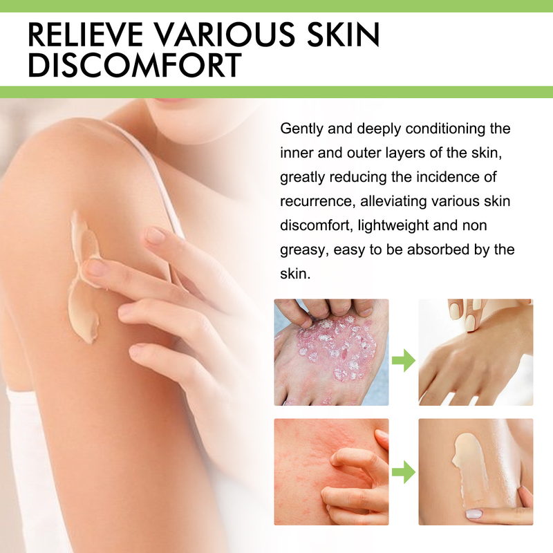 South Moon Skin Cream, itchy, itchy, sensitive, red, itchy, antibacterial topical cream_voghion.com