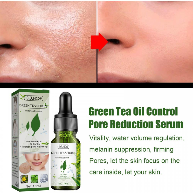 Serum za obnovu lica sa zelenim čajem, umirujući serum za kontrolu masnoće, serum za skupljanje pora, izbjeljivanje lica, uklanjanje tamnih mrlja, akni i mitesera, njega kože_voghion.com