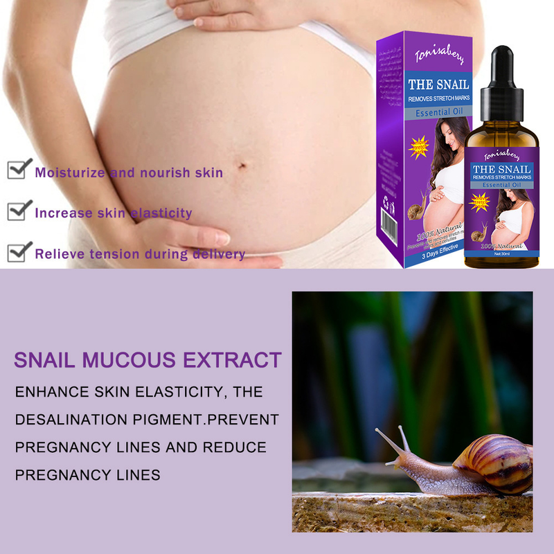 Specialize Vatsahierontaöljy synnytyksen jälkeiseen venytykseen 30ml_voghion.com