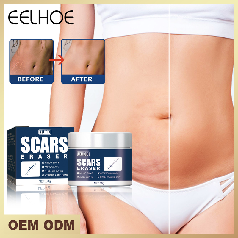 EELHOE Impacco freddo Bruciore Attenuante Riparazione chirurgica Levigante Crema gel per cicatrici cutanee_voghion.com