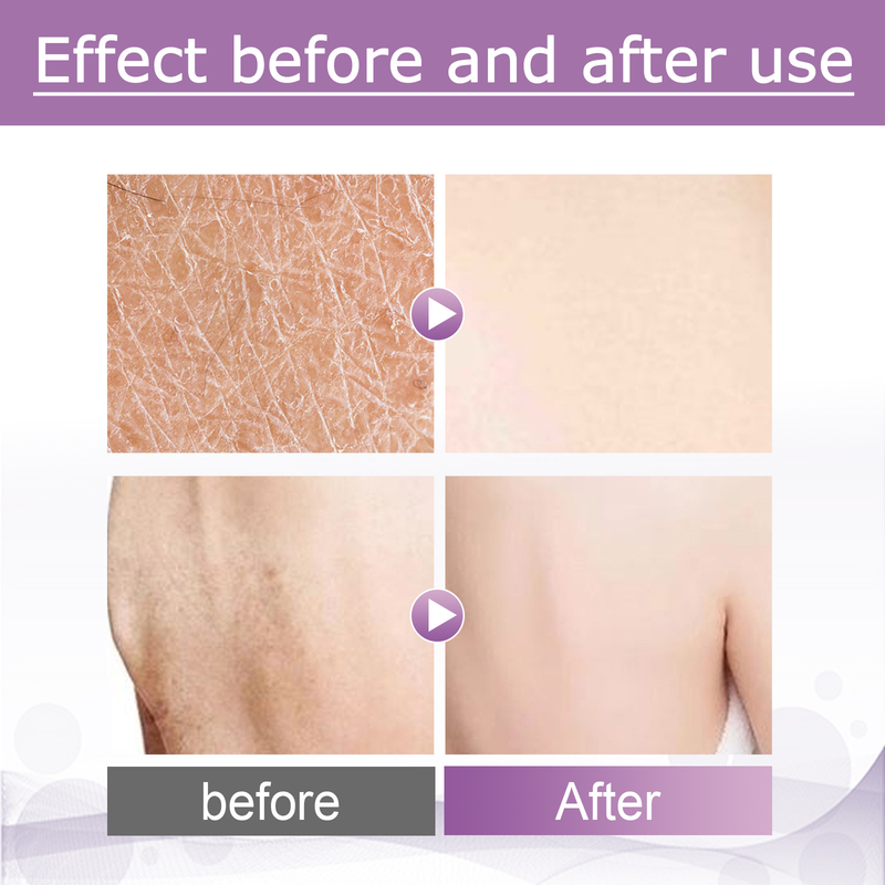 EELHOE Scrub corpo ruvido Esfoliante Pulizia profonda Levigante Scrub corpo ringiovanente_voghion.com
