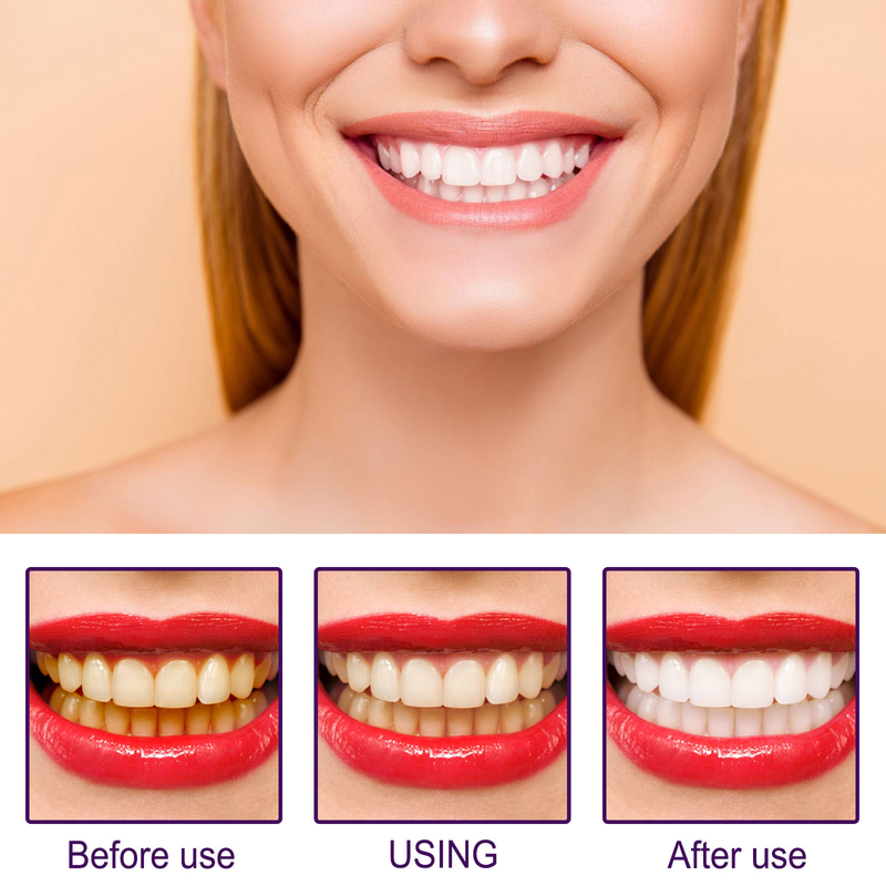 EELHOE V34 Purple Toner Whitening Pen für Zahnreinigung, Fleckenentfernung, Pigmentprävention und Mundpflege_voghion.com