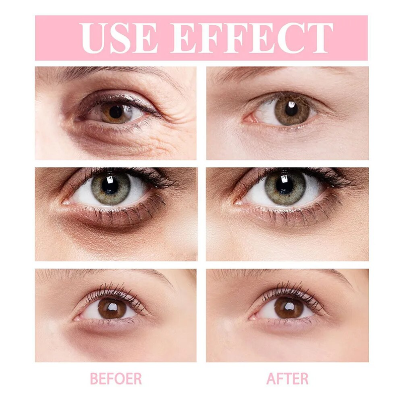 Anti-Wrinkle Eye Cream Fade Fine Line Whitening Moisturize Skin Anti Puffiness Removing wrinkles dark circle eye cream Skincare_voghion.com