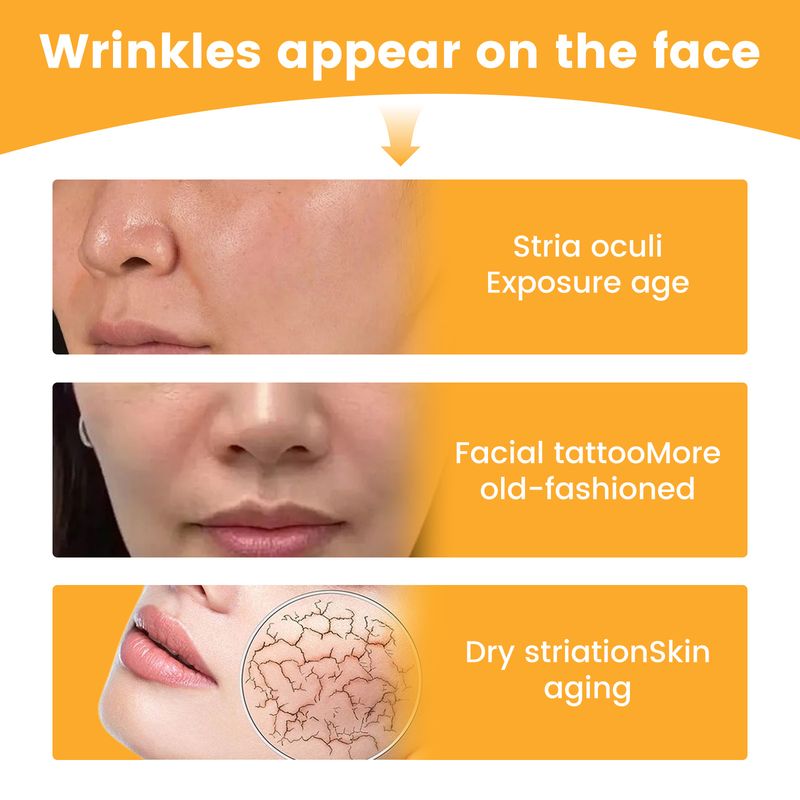 EELHOE Nasolabial Folds Patch, Fading Fine Linjer, Lovlige Linjer, Løfter og Strammer Ansigtshuden Fugtgivende og Hydrerende_voghion.com