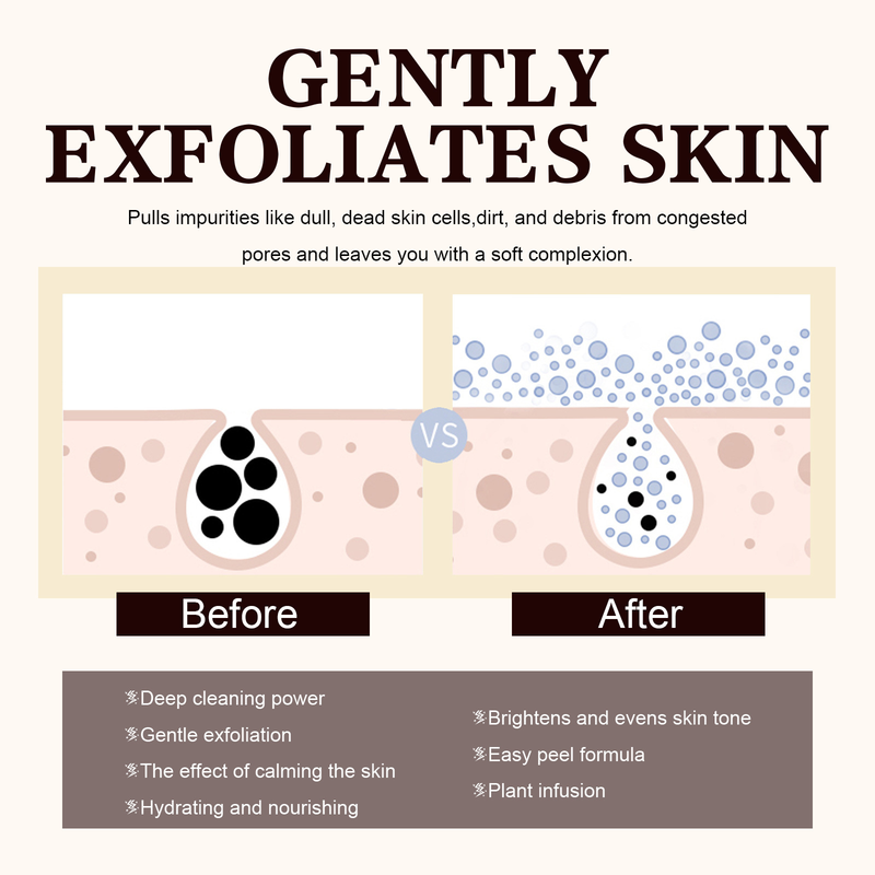 West&Month Peel-off Feuchtigkeitsspendend, aufhellend, Mitesser entfernend, Poren straffend, Pickel verkleinern Gesichtsmaske auftragen_voghion.com