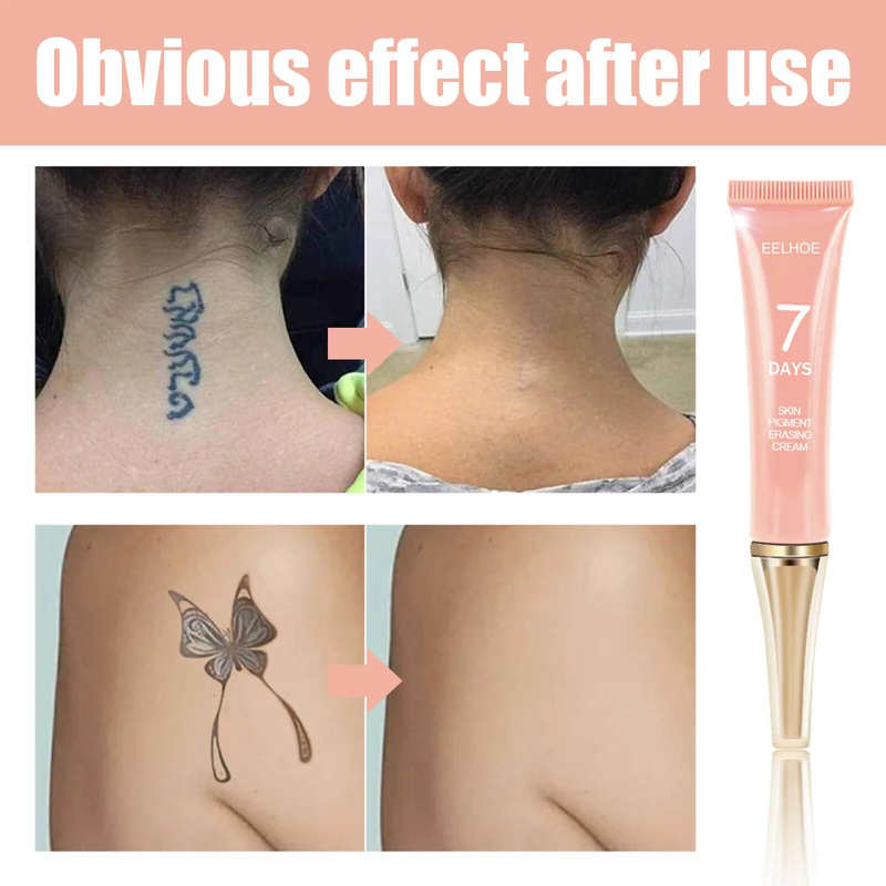 Crème d'effacement des pigments de la peau, tube indolore, crème d'effacement des tatouages, Portable, nettoyage des tatouages, Gel pour la peau indolore, 13g pour femmes_voghion.com