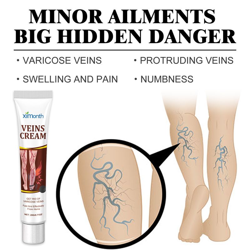 Ximonth Soulagement de la douleur, du gonflement et de l'inconfort dans les jambes dus aux tendons bleus, crème de soin de massage veineux_voghion.com