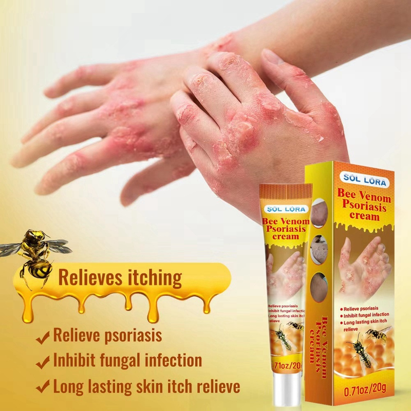 SOL LORA Be Venom Relieving Itching Repairing Hand and Foot Moss Skin Repair Cream_voghion.com