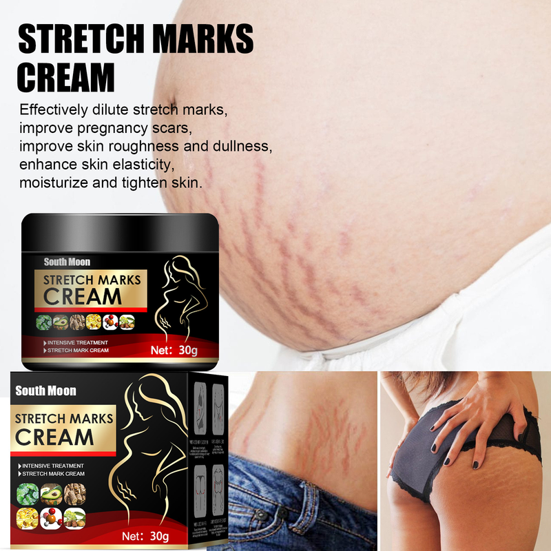 La crema reparadora del embarazo South Moon repara y reafirma la piel, desvanece las cicatrices posparto y las líneas corporales de obesidad del embarazo._voghion.com