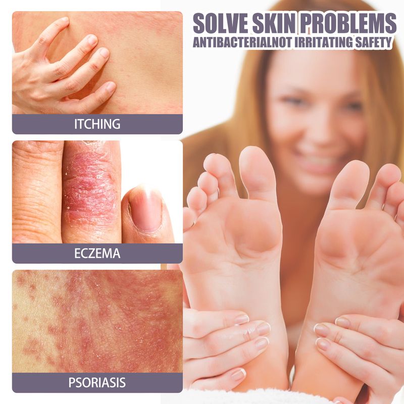 2025 Hand Foot Relieves Dry Rough Skin, Nourishes, And Moisturizes Skin Care Spray_voghion.com