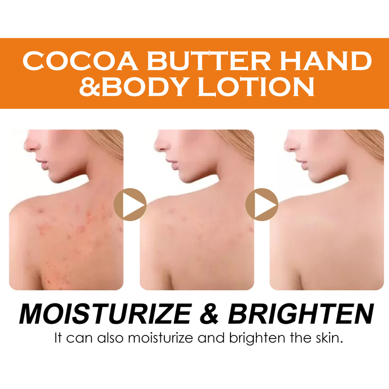 Aufhellende Körperlotion, entfernt Melanin, hellt dunkle Flecken auf, Anti-Aging, glättet, macht weich, spendet Feuchtigkeit, erhellt die Haut, Kakaobuttercreme_voghion.com
