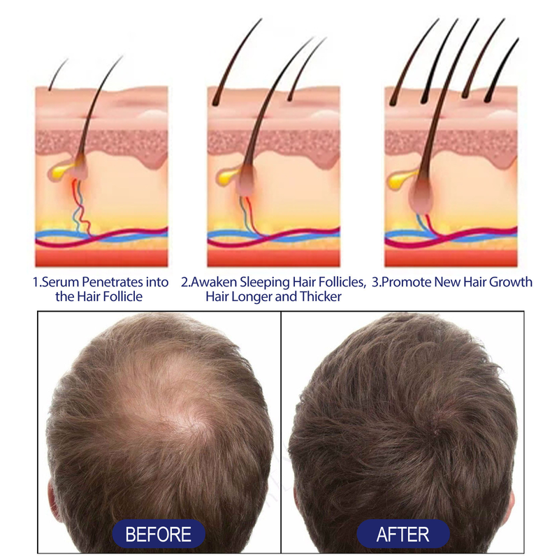 2024 foam Men's Deep Repair Root Hair Follicle Dense Moisturizing Care_voghion.com