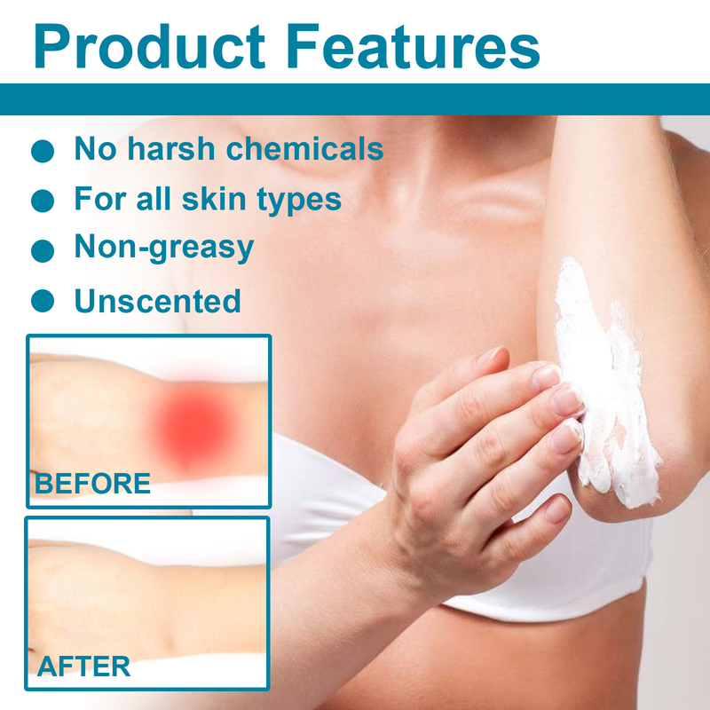 EELHOE Cream Relieve Tattoo Skin Care Pain Repair Embroidery_voghion.com