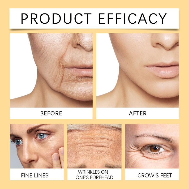 Woodsleep Bee Venom Moisturizing And Firming Lotion, Lifting And Firming Skin Hydrating And Moisturizing Refreshing Lotion_voghion.com