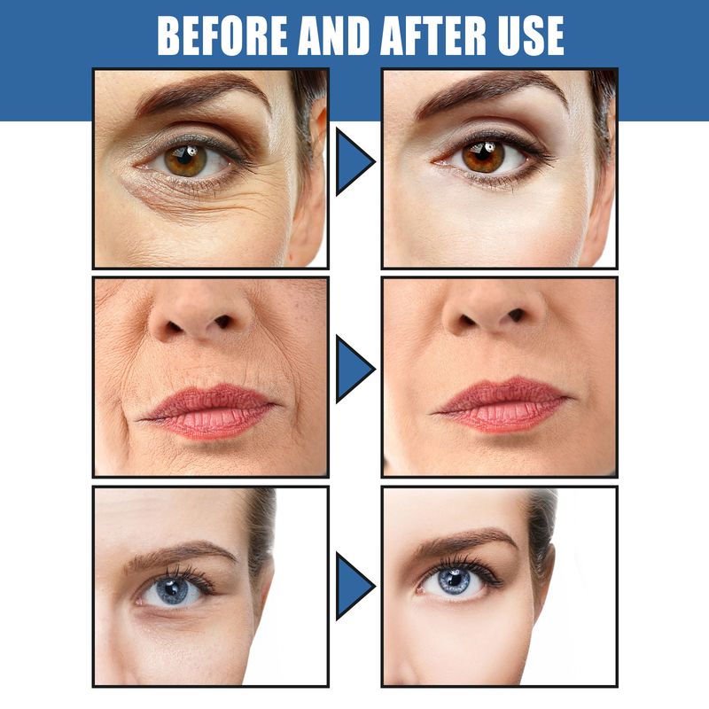 West&Month 5 Seconds Retinol Cream To Reduce Fine Lines Under Eyes Hydrating Moisturizing Cream To Soften Skin_voghion.com
