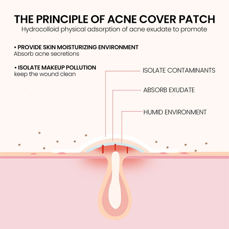 Jaysuing Pimples Patch, Repair Pockmarks Lighten Pimples Blemishes Cover Pimples_voghion.com