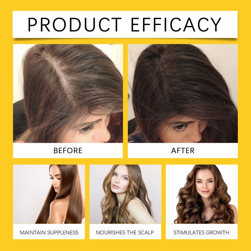 Hair Follicle Essence Deep Repair Damage Nourishing Growth Smoothing Oil Promote Regeneration Hydrate Fixing Dense Hair Products_voghion.com