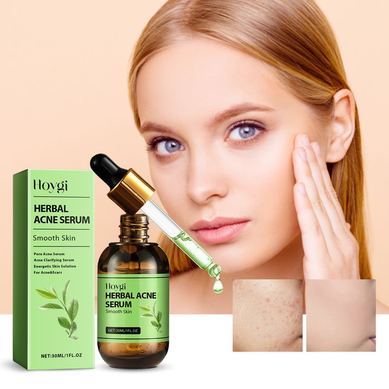 Hoygi Herbal Acne Serum, Reduce Acne Pimples With A Comprehensive Moisturizing Moisturizer_voghion.com