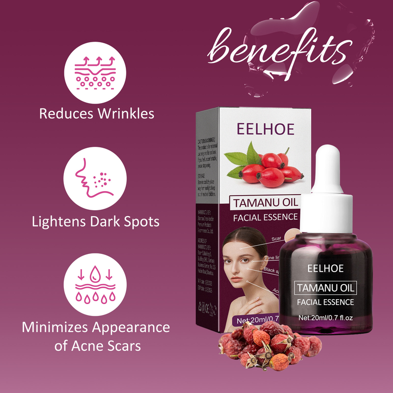 Qiongya Begonia Belle huile essentielle élimine l'acné, ferme la bouche, rétrécit les pores, répare les muscles sensibles et_voghion.com