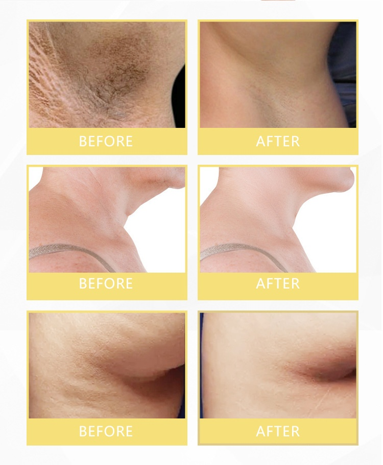 AUQUEST Achselcreme hellt Melanin auf, bekämpft Gerüche, wirkt gegen Ausfransen, beugt Ausfransungen vor und ist eine Körperlotion_voghion.com