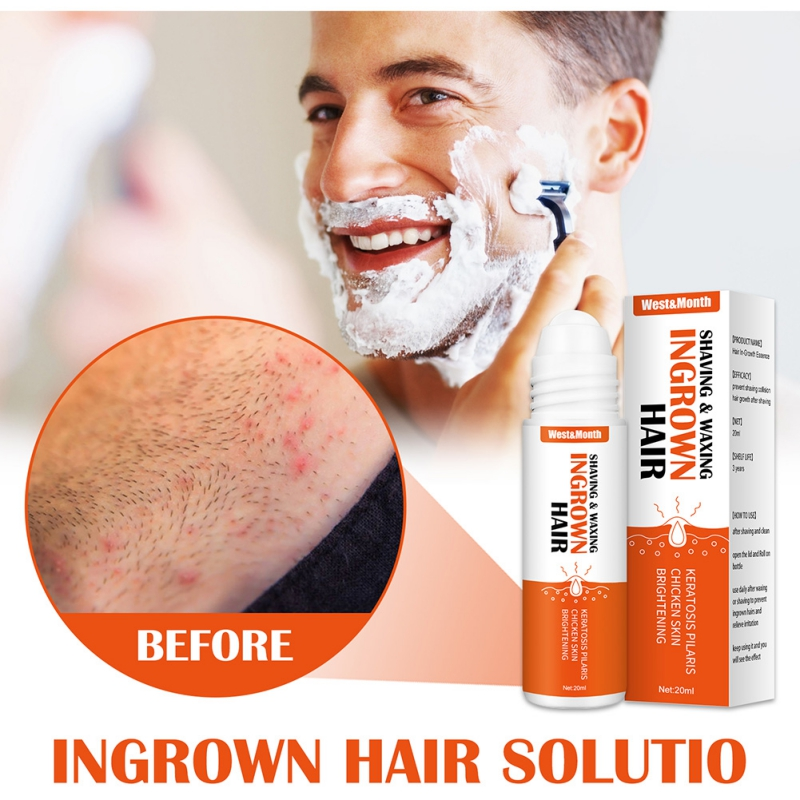 20ml Soluție ser reparator după ras Calmează epilarea cu ceară Păr crescut sub piele Reduce roșeața pielii Previne iritațiile de la ras Frumusețe și sănătate Sigură_voghion.com