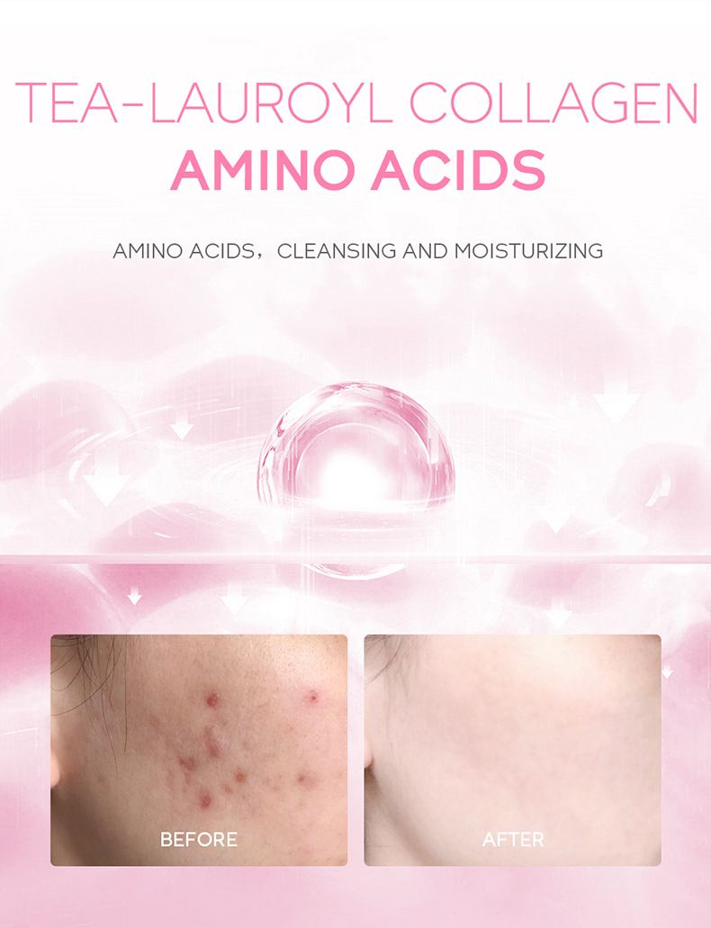 FENYI Sakura 4 daļu ādas kopšanas produktu komplekts mitrinošs un saudzīgs 1 daļas 2 g izmēģinājuma iepakojums ādas kopšanai_voghion.com