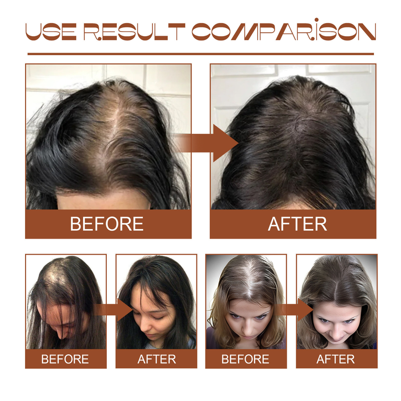 Batana Oil EELHOE Haarspülung spendet Feuchtigkeit, repariert die Haarwurzeln, stärkt, beugt Haarausfall vor, macht das Haar weich und fest_voghion.com