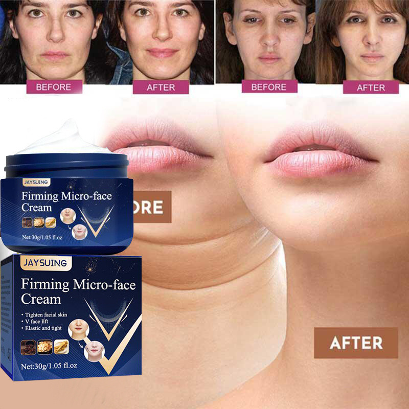 Creme Ansigtsløftning Slankende Tynd V Ansigtsløftning Opstrammende Fjernelse Masseter Muscle Dobbelthage Anti-aging Fugtgivende Skønhed_voghion.com