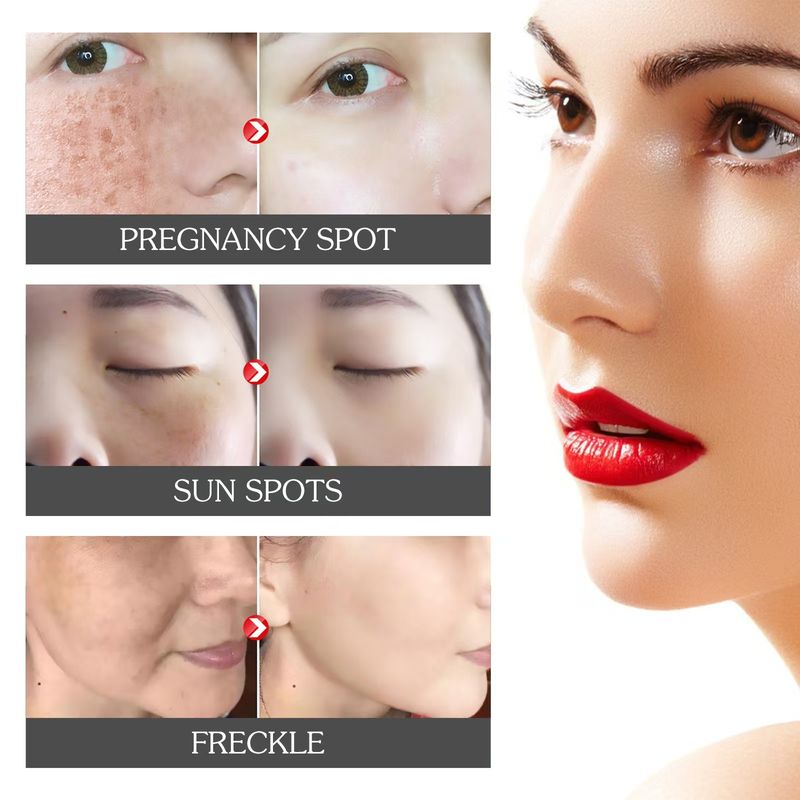 Curcumic acid can effectively fade and remove dark spots on the face essence oil_voghion.com