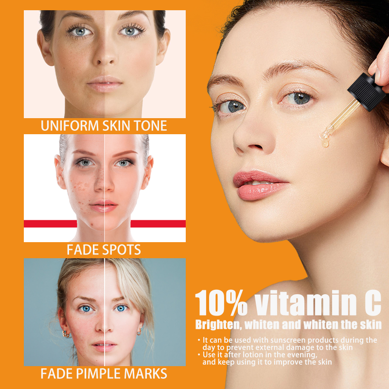 Βιταμίνη C ορού για λεύκανση προσώπου Ορός προσώπου με υαλουρονικό οξύ για αφαίρεση μαύρων κηλίδων Κορεατικά προϊόντα περιποίησης δέρματος Sk_voghion.com