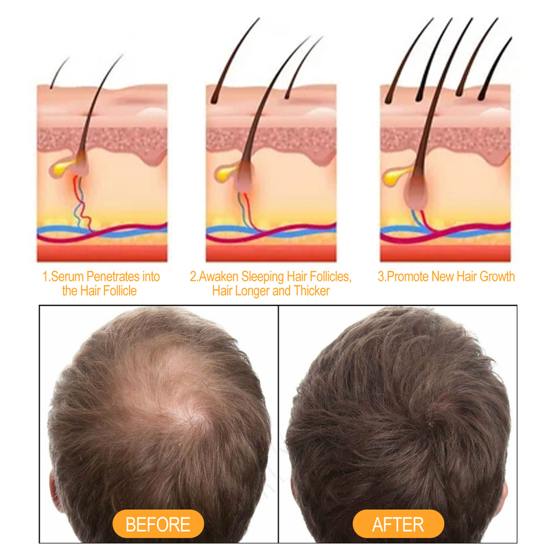EELHOE Shampoo nutriente forte per le radici allo zenzero, ripara la caduta dei capelli e fissa lo shampoo_voghion.com