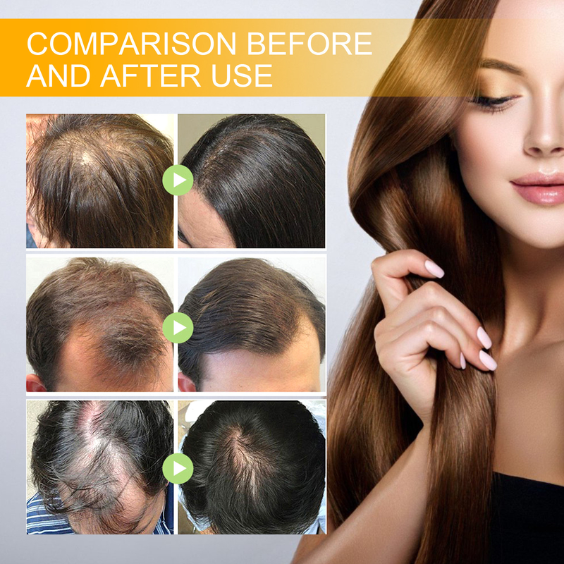 EELHOE Spray per la crescita dei capelli alla biotina Massaggio per capelli forti Cuoio capelluto Capelli spessi Liquido nutriente rassodante anticaduta_voghion.com
