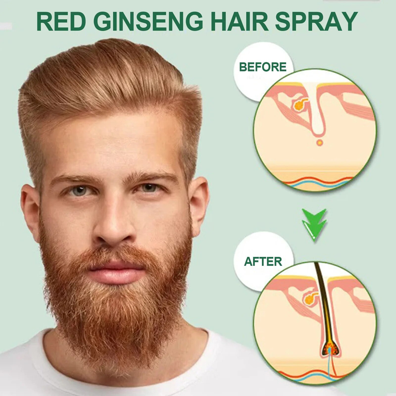 Siero Spray Crescita Ginseng Rosso Ripristina Calvizie Diradamento Cuoio Capelluto Trattamento Più Spesso Idratante Nutrizione Anti H_voghion.com