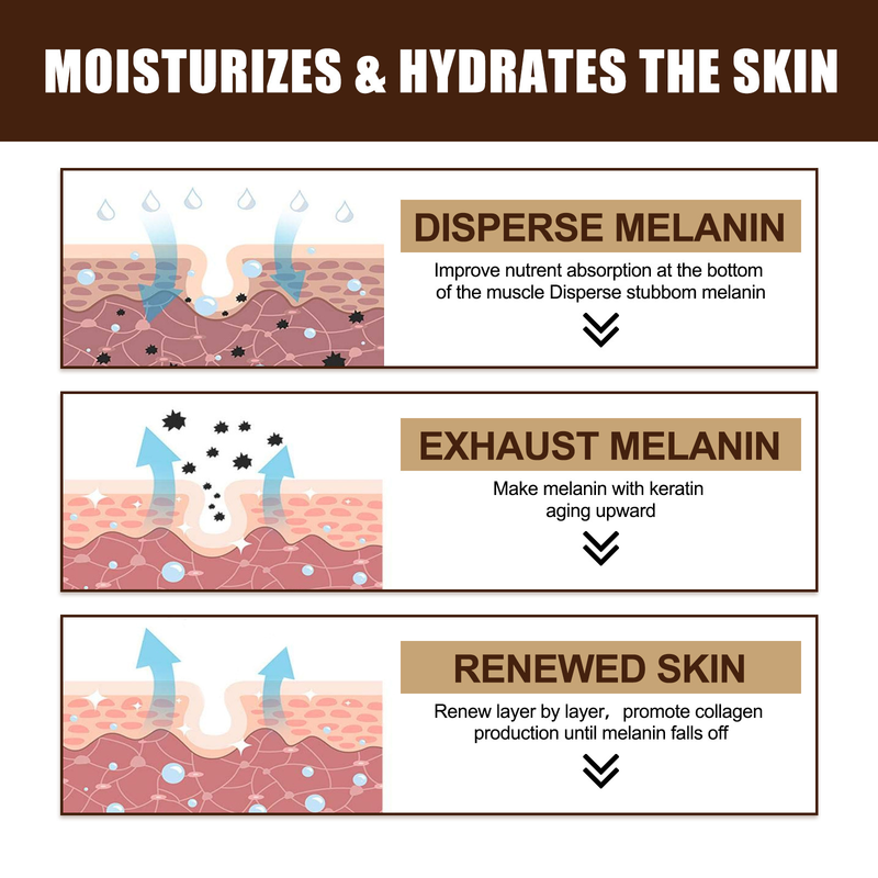 Cream Beautiful Freckle Moisturizes and Moisturizes Freckles, Blackspots, Yellowish Brown Spots, and Melanin Whitening s,_voghion.com