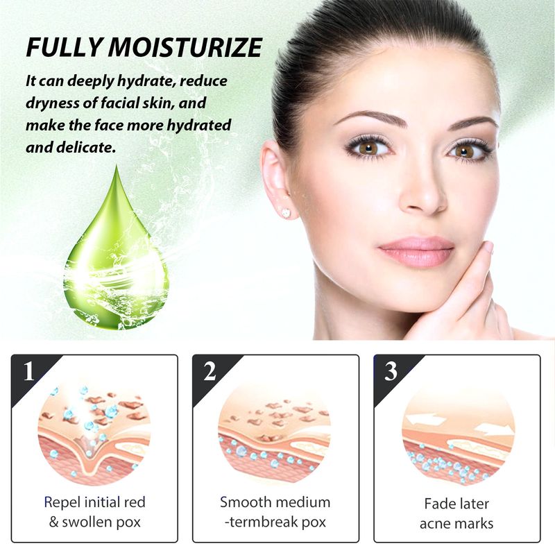 Hoygi Herbal Acne Serum, Reduce Acne Pimples With A Comprehensive Moisturizing Moisturizer_voghion.com