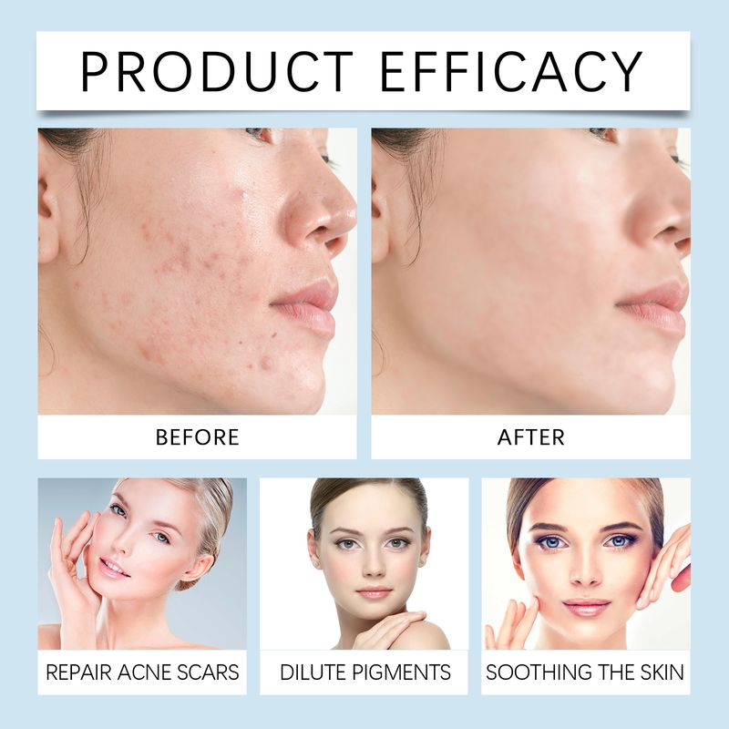 OUHOE Herbal Relief Spray For Facial Discomfort Herbal Essence Gently Moisturizes And Soothes Skin_voghion.com