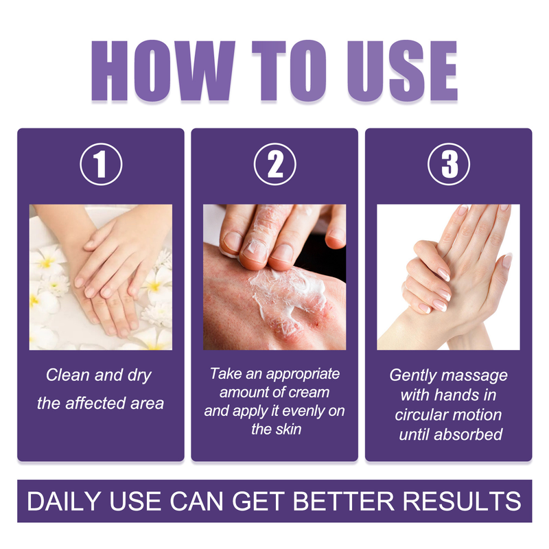 EELHOE Skin Repair Cream käte jalasambla parandamiseks, sügeluse ja punetuse leevendamiseks ning niisutav nahahoolduskreem_voghion.com