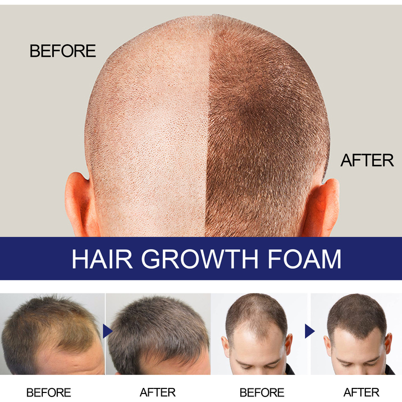 2024 foam Men's Deep Repair Root Hair Follicle Dense Moisturizing Care_voghion.com
