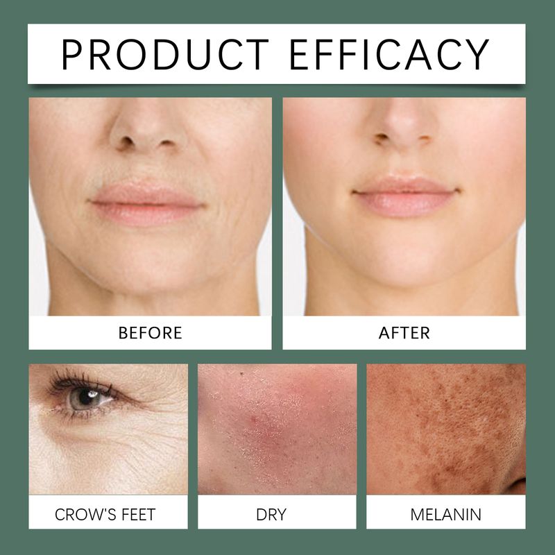 West&Month Moisturizing And Firming Essence, Moisturizing And Hydrating Facial Tender Skin And Enhancing Skin Texture Essence_voghion.com