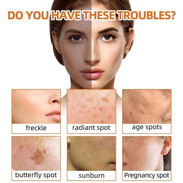West&Month Turmeric Face Soap, Face Repair Gentle Cleansing, Fade Spots And Smooth Fine Lines Cleaner Soap_voghion.com