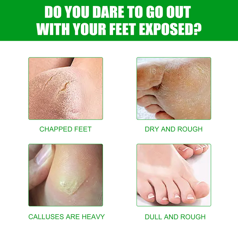 Aloe Fuß Schöne Maske für Entfernen Abgestorbene Haut, Feuchtigkeitsspendende, Feuchtigkeitsspendende, und Feuchtigkeitsspendende Fuß Maske für Prävention_voghion.com