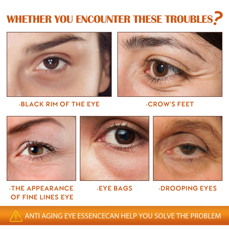 Esența anti-îmbătrânire Beautiful Eye repară ochii, estompează liniile fine ale ochilor, cearcănele și pungile de sub ochi._voghion.com