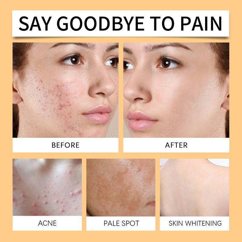 Hoygi Turmeric Cleansing Soap Gently Cleans And Moisturizes Body Skin Delicate, Clean And Refreshing Cleansing Soap_voghion.com