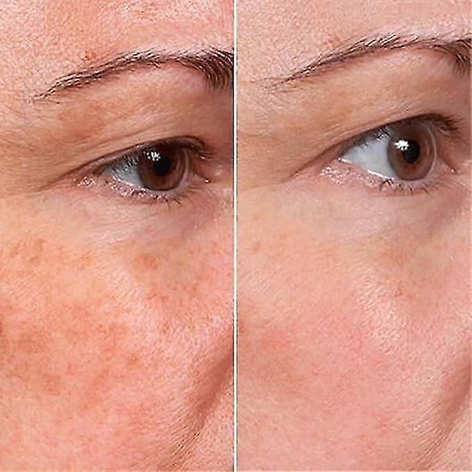 Verjüngendes Gesichtsserum, verjüngendes Gesichtsserum zur Erneuerung der Hautpflege, Verjüngung, Anti-Falten und Entfernung dunkler Flecken, tiefe Feuchtigkeitsversorgung, für Männer und Frauen_voghion.com